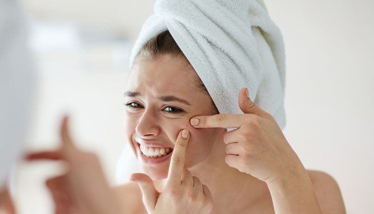 4 Tips Cara Alami Mengatasi Jerawat